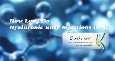 How Long Do Hyaluronic Knee Injections Last?