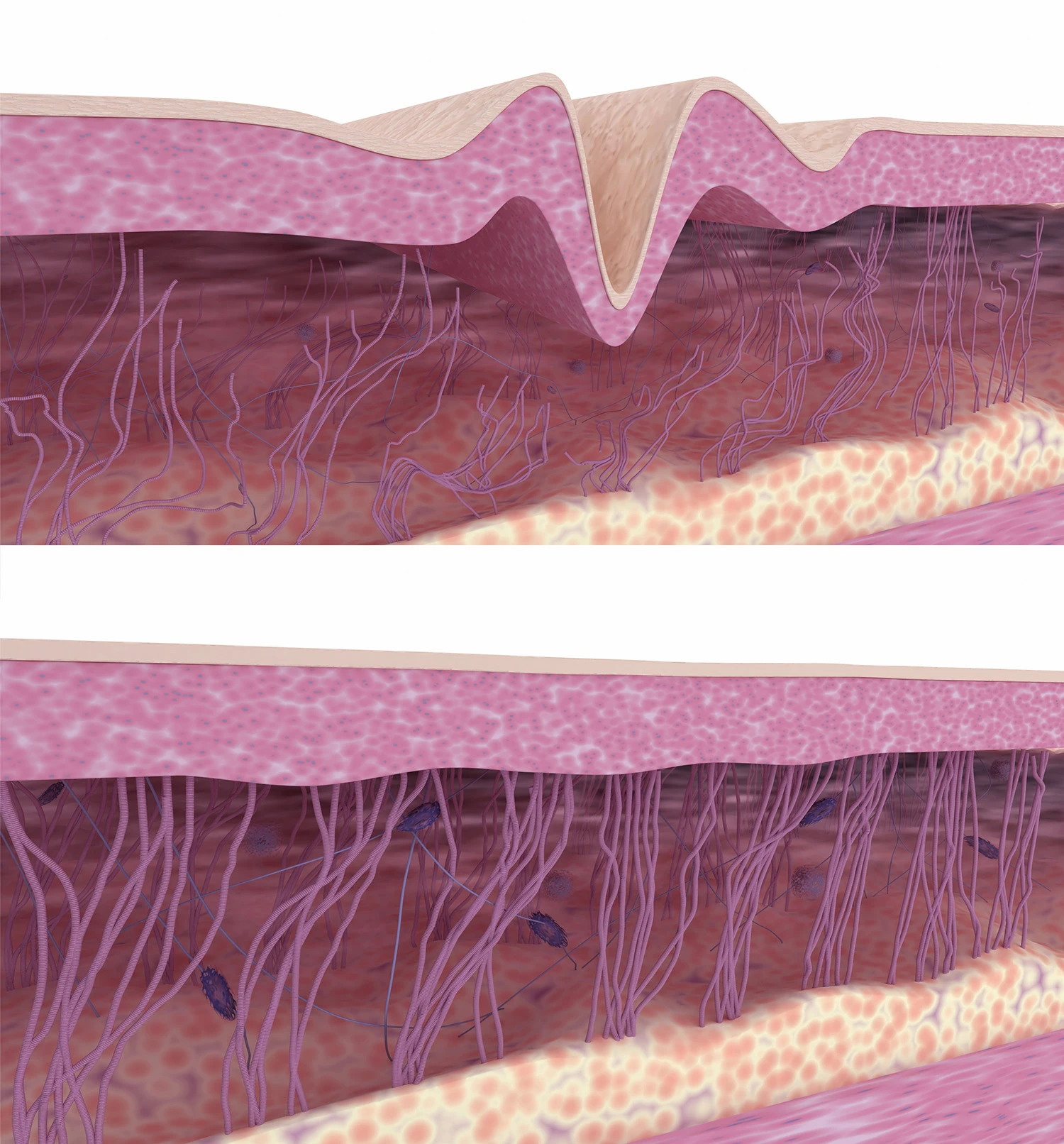 collagen regeneration collagen regeneration