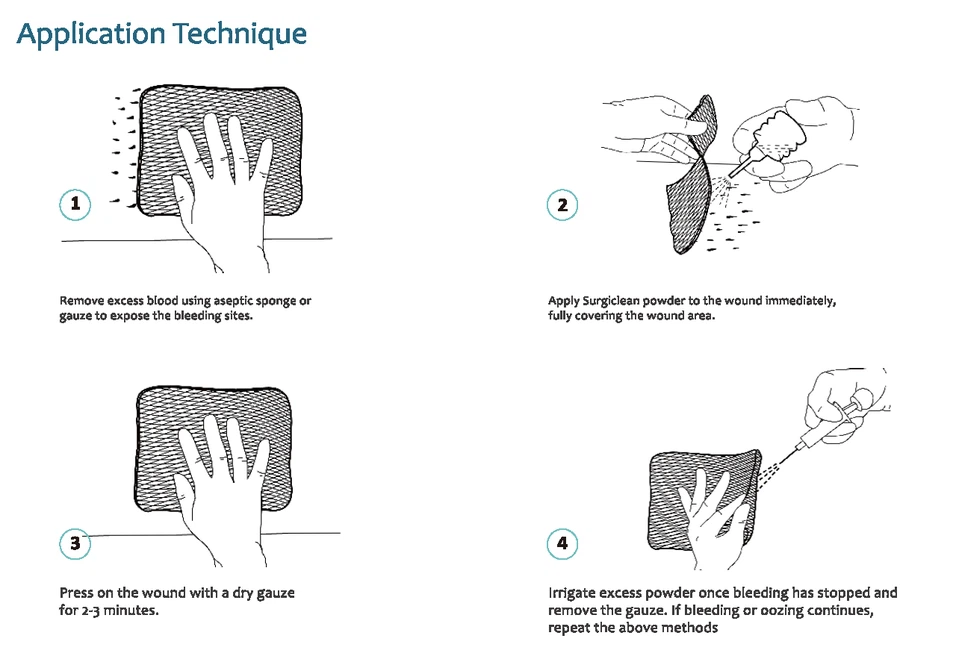 Surgical-Wound-Dressing Surgical-Wound-Dressing