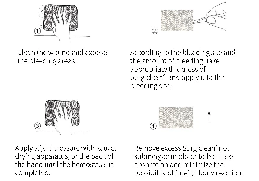Surgiclean-Soluble-Hemostatic-Gauze Surgiclean-Soluble-Hemostatic-Gauze